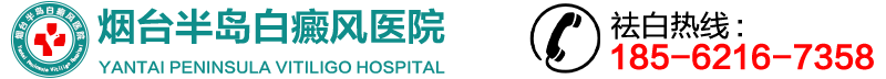 烟台半岛白癜风医院