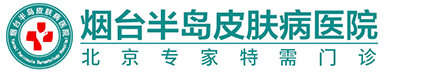 烟台半岛白癜风医院
